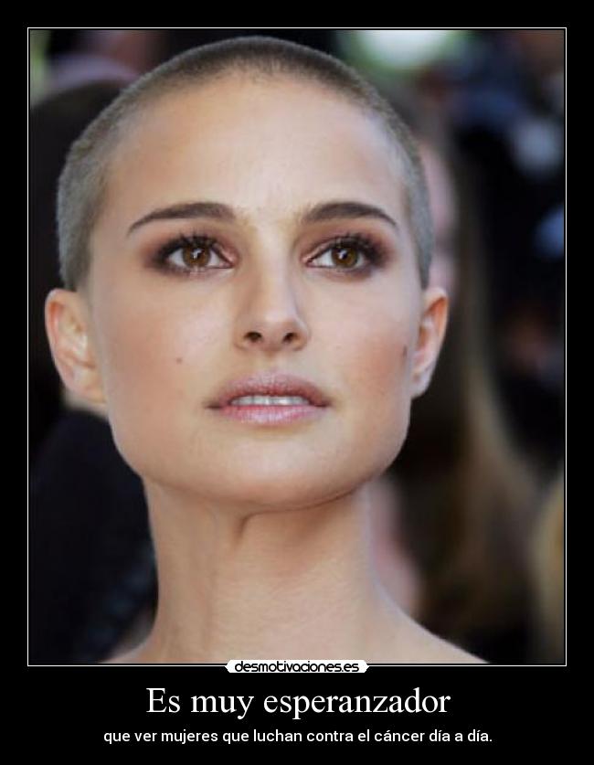 Es muy esperanzador - que ver mujeres que luchan contra el cáncer día a día.