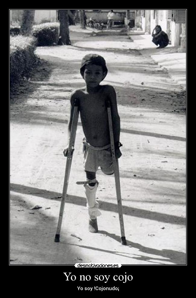 Yo no soy cojo - Yo soy !Cojonudo¡