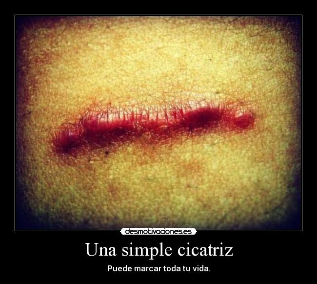 Una simple cicatriz -