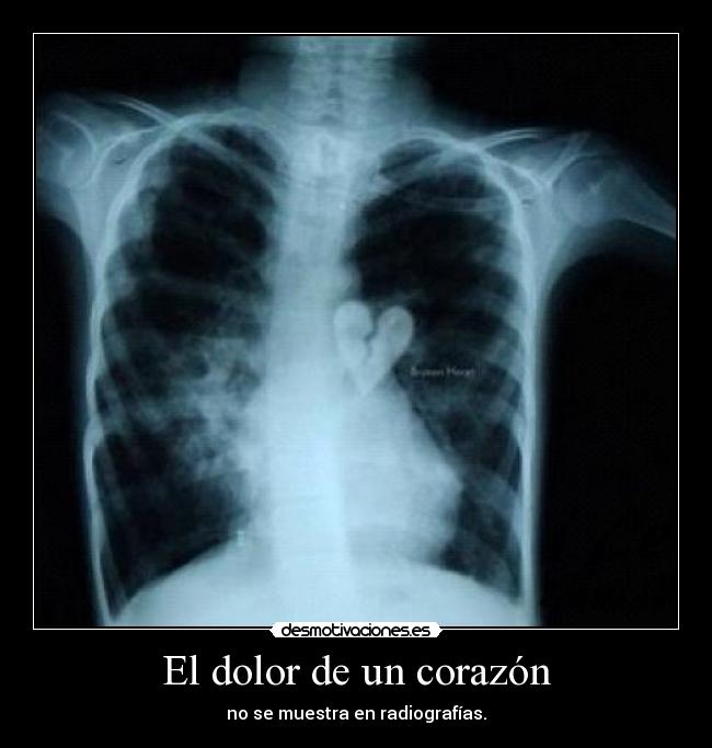 carteles dolor corazon xenon desmotivaciones