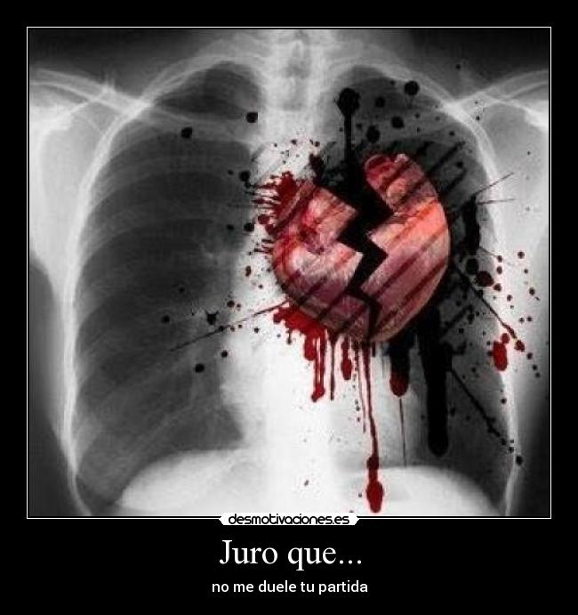 Juro que... - no me duele tu partida