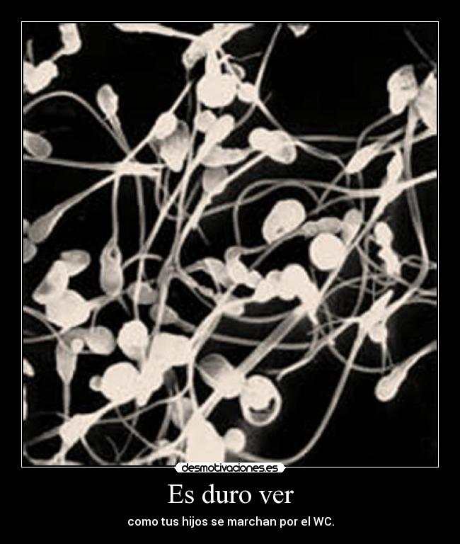 Es duro ver - 