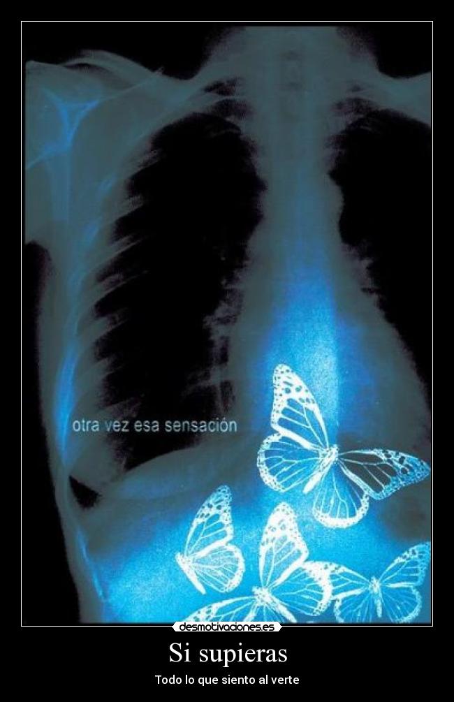 Si supieras - Todo lo que siento al verte