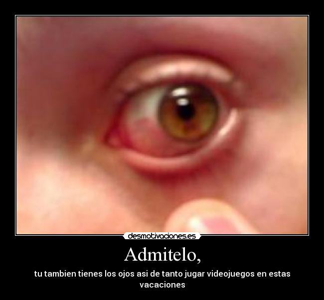 carteles ojos jugar videojuegos desmotivaciones