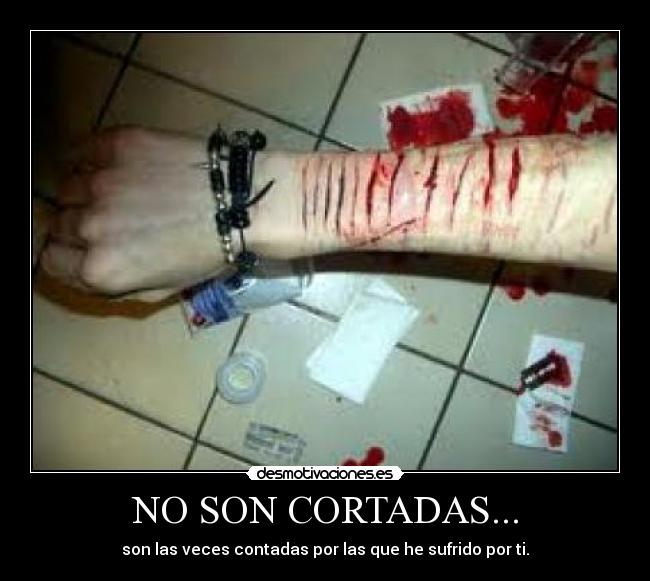 NO SON CORTADAS... - son las veces contadas por las que he sufrido por ti.