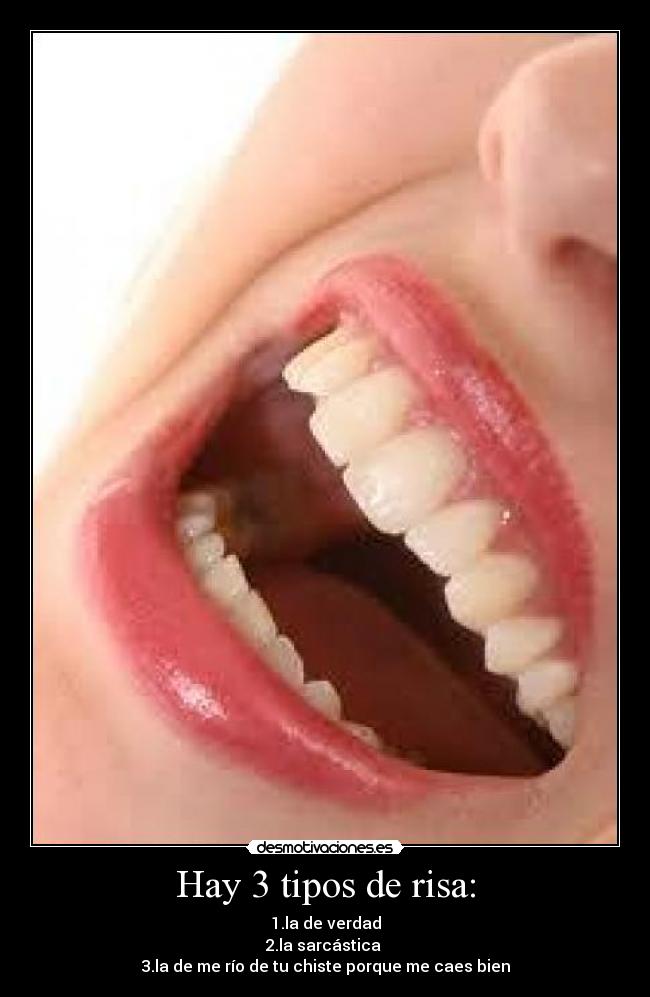 Hay 3 tipos de risa: -