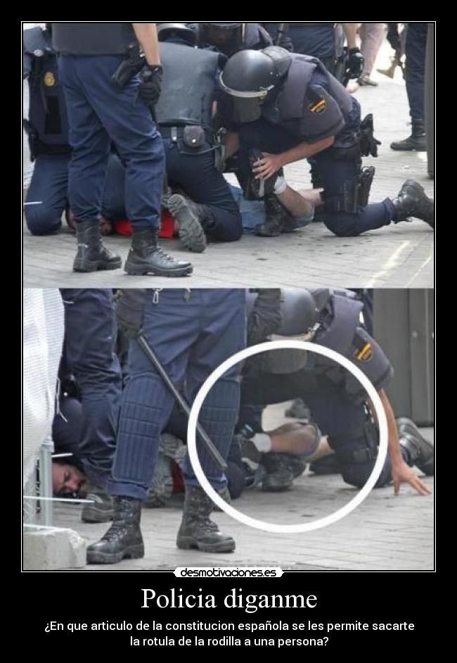 Policia diganme - ¿En que articulo de la constitucion española se les permite sacarte
la rotula de la rodilla a una persona?