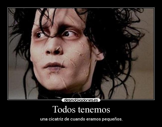 Todos tenemos - una cicatriz de cuando eramos pequeños.