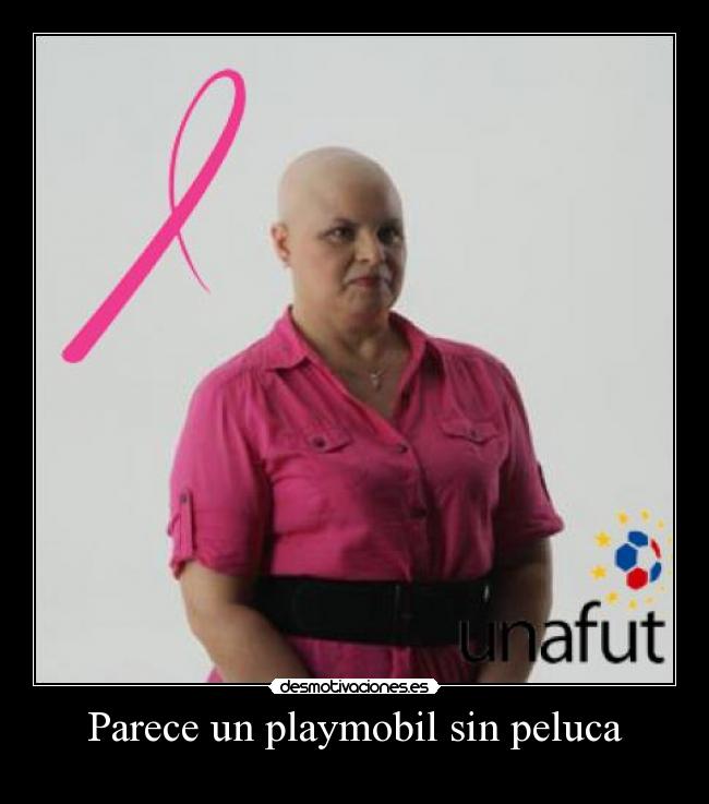 Parece un playmobil sin peluca - 