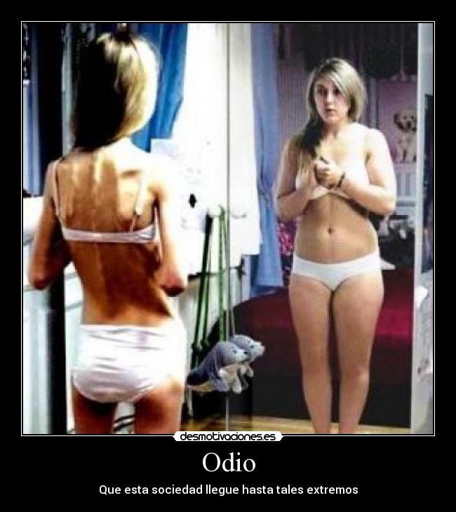 Odio - Que esta sociedad llegue hasta tales extremos