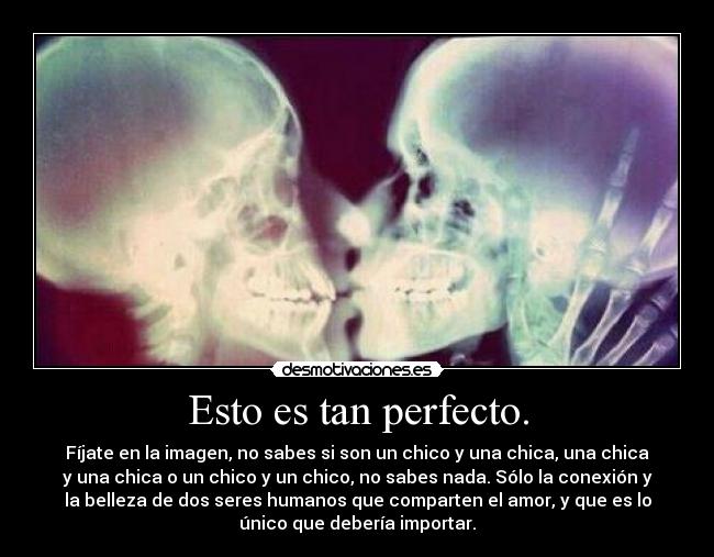 Esto es tan perfecto. - Fíjate en la imagen, no sabes si son un chico y una chica, una chica
y una chica o un chico y un chico, no sabes nada. Sólo la conexión y
la belleza de dos seres humanos que comparten el amor, y que es lo
único que debería importar.
