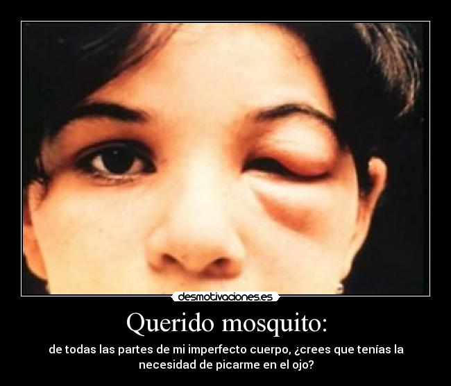 Querido mosquito: - de todas las partes de mi imperfecto cuerpo, ¿crees que tenías la
necesidad de picarme en el ojo?