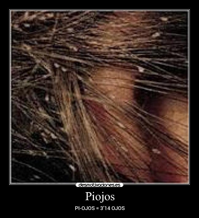 Piojos - PI-OJOS = 314 OJOS