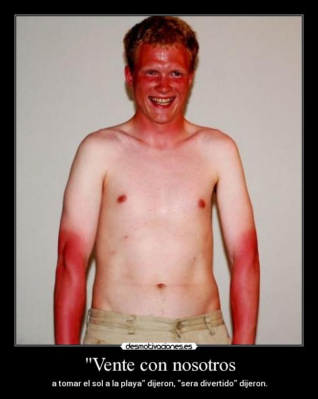 Vente con nosotros - a tomar el sol a la playa dijeron, sera divertido dijeron.