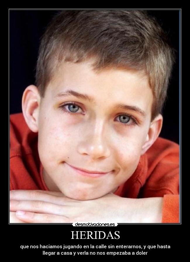 HERIDAS - que nos haciamos jugando en la calle sin enterarnos, y que hasta
llegar a casa y verla no nos empezaba a doler