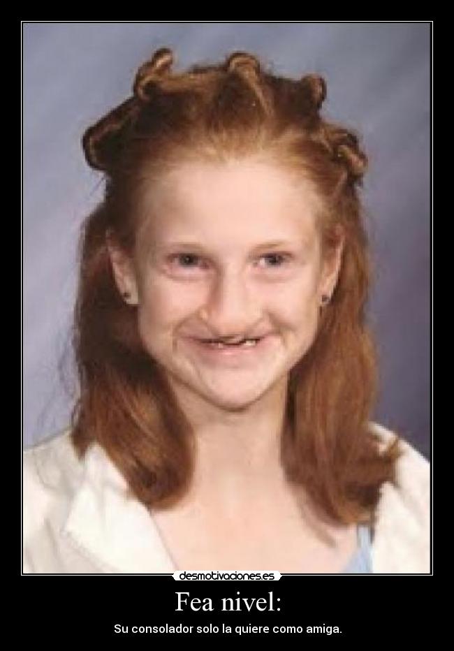 Fea nivel: -