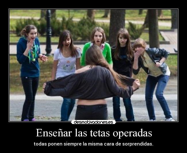 Enseñar las tetas operadas -