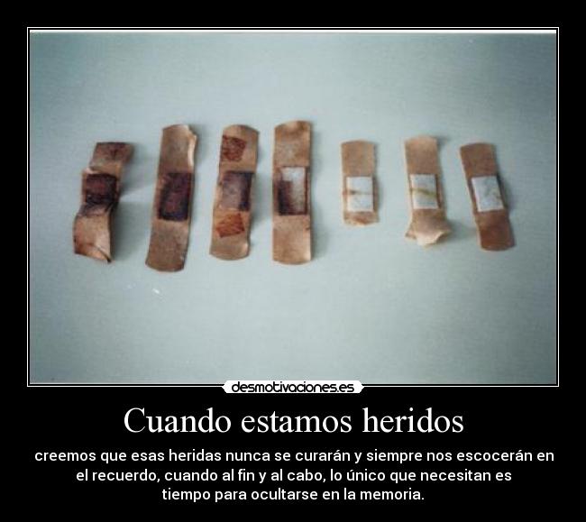 Cuando estamos heridos - creemos que esas heridas nunca se curarán y siempre nos escocerán en
el recuerdo, cuando al fin y al cabo, lo único que necesitan es
tiempo para ocultarse en la memoria.
