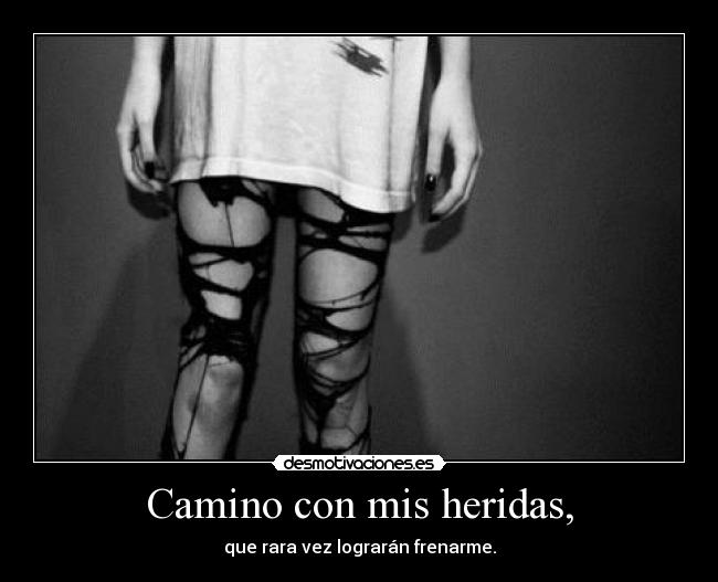 Camino con mis heridas, -