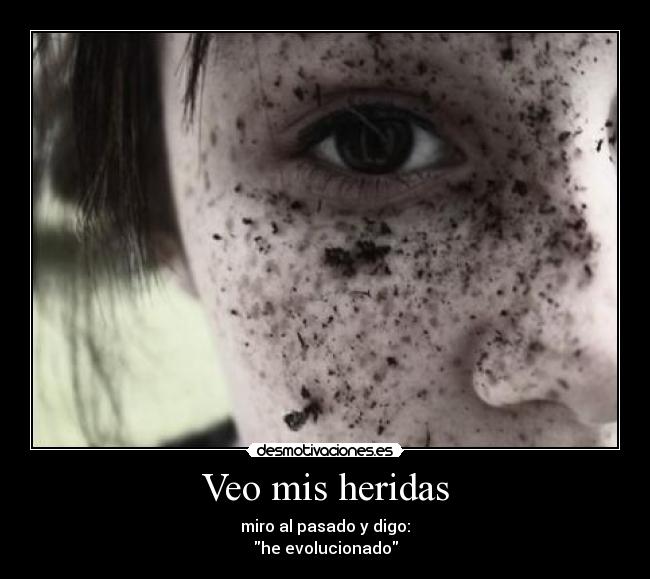 Veo mis heridas - 