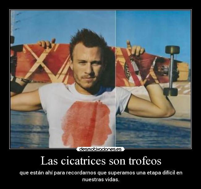 Las cicatrices son trofeos - que están ahí para recordarnos que superamos una etapa difícil en nuestras vidas.