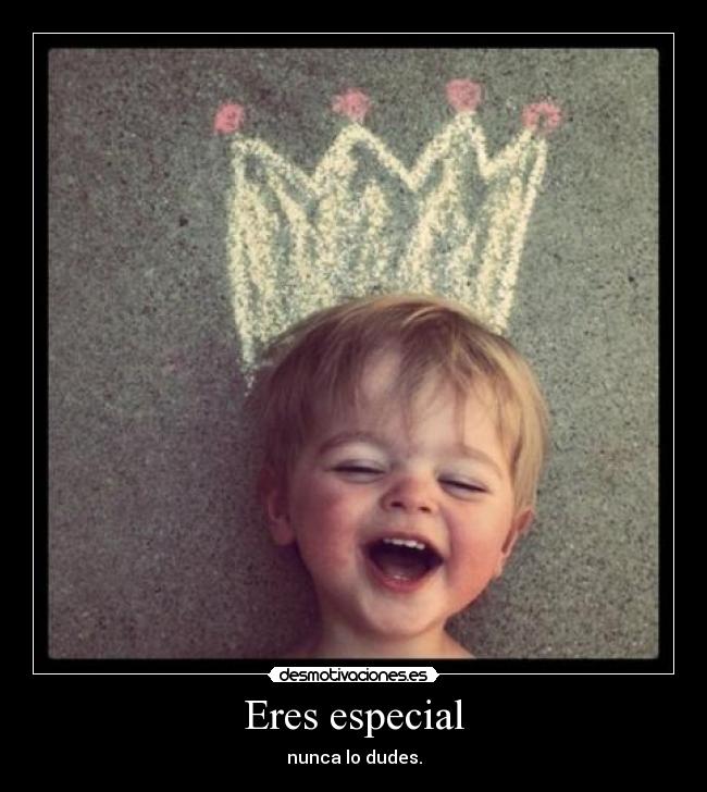 Eres especial - nunca lo dudes.