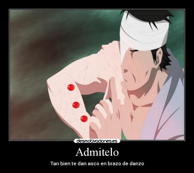 Admitelo - Tan bien te dan asco en brazo de danzo