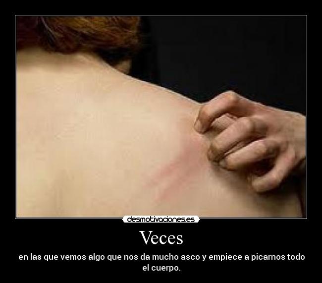 Veces - en las que vemos algo que nos da mucho asco y empiece a picarnos todo el cuerpo.