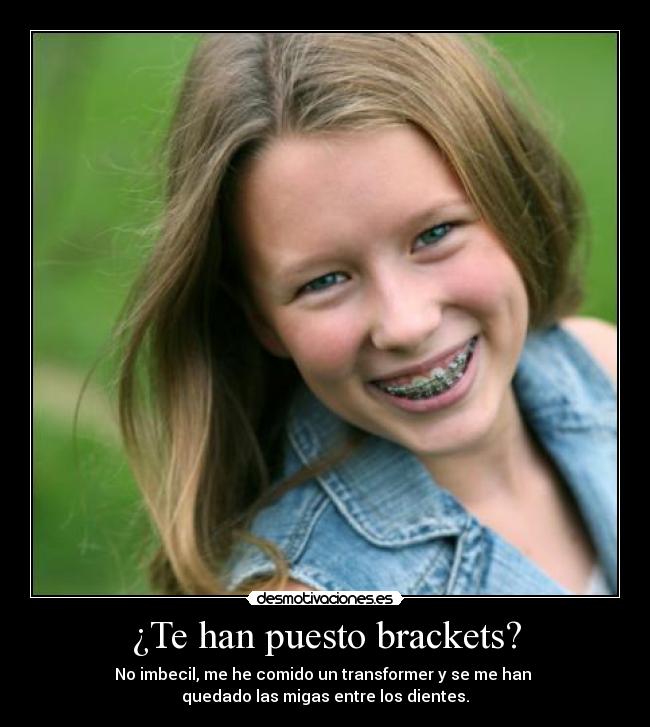 ¿Te han puesto brackets? - 