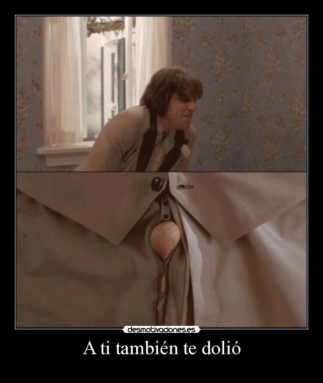 A ti también te dolió -