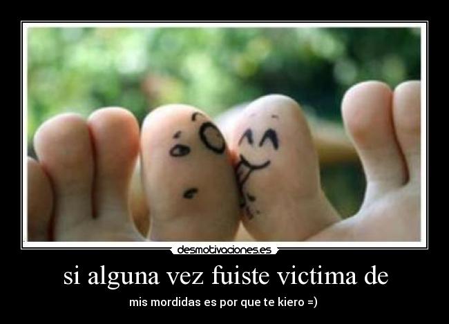 si alguna vez fuiste victima de - mis mordidas es por que te kiero =) ♥