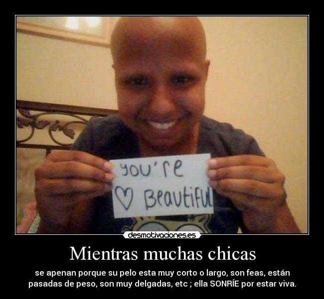 Mientras muchas chicas - se apenan porque su pelo esta muy corto o largo, son feas, están
pasadas de peso, son muy delgadas, etc ; ella SONRÍE por estar viva.