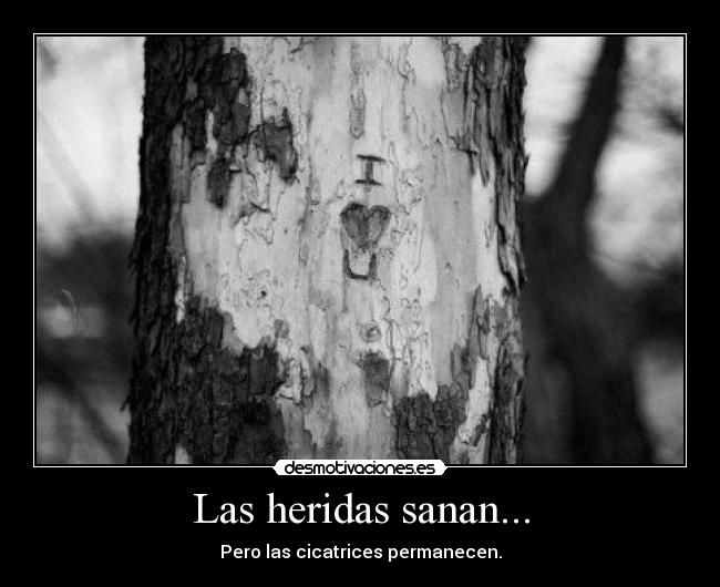 Las heridas sanan... - Pero las cicatrices permanecen.