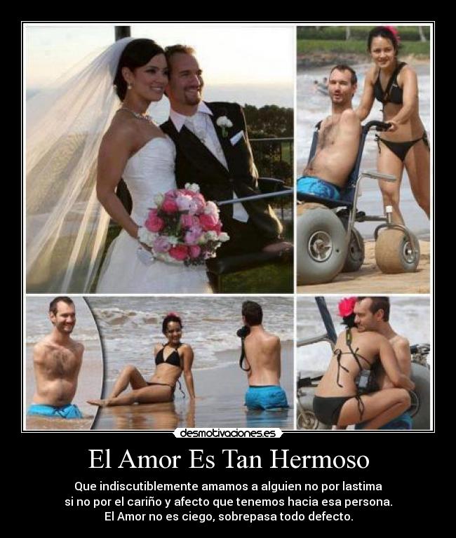 El Amor Es Tan Hermoso -