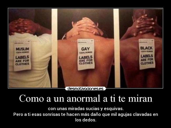 Como a un anormal a ti te miran - con unas miradas sucias y esquivas.
Pero a ti esas sonrisas te hacen más daño que mil agujas clavadas en los dedos.