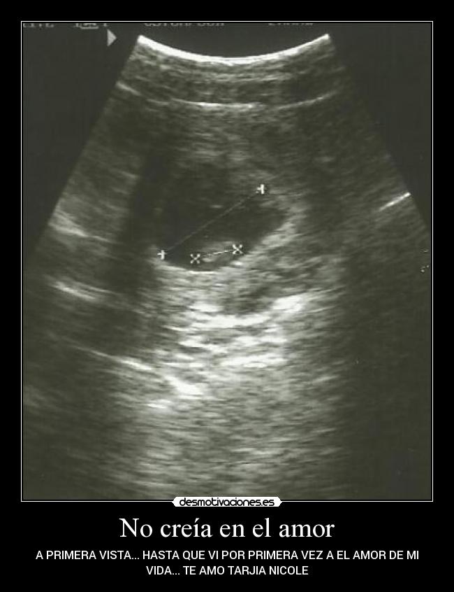 No creía en el amor - A PRIMERA VISTA... HASTA QUE VI POR PRIMERA VEZ A EL AMOR DE MI
VIDA... TE AMO TARJIA NICOLE