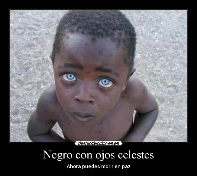 Negro con ojos celestes - Ahora puedes morir en paz