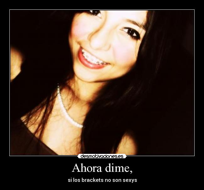 Ahora dime, - si los brackets no son sexys