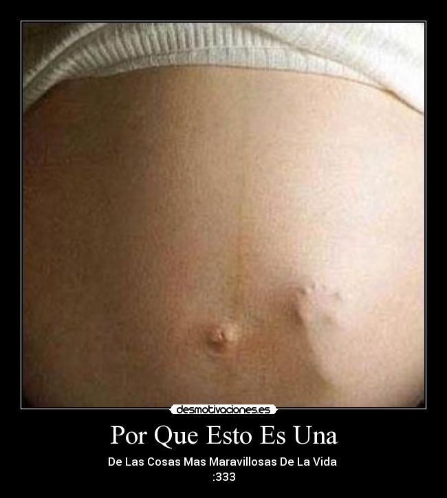 Por Que Esto Es Una - De Las Cosas Mas Maravillosas De La Vida 
:333