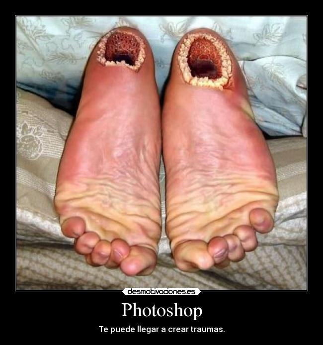 Photoshop - Te puede llegar a crear traumas.