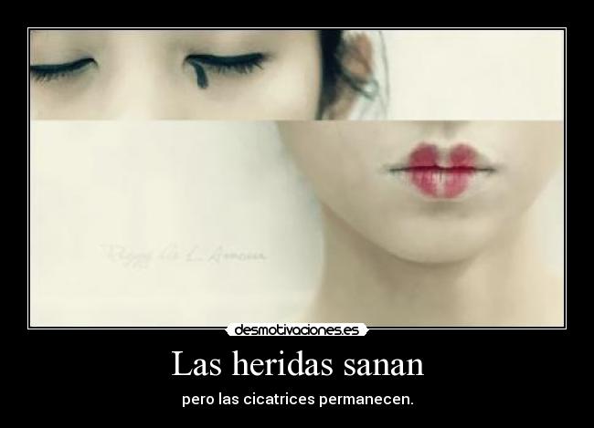 Las heridas sanan - pero las cicatrices permanecen.