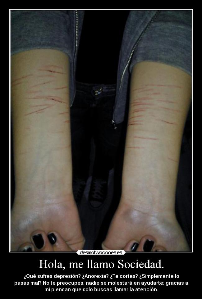 Hola, me llamo Sociedad. - ¿Qué sufres depresión? ¿Anorexia? ¿Te cortas? ¿Simplemente lo
pasas mal? No te preocupes, nadie se molestará en ayudarte; gracias a
mí piensan que solo buscas llamar la atención.