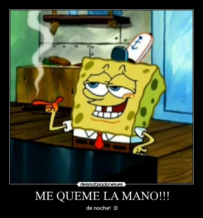 ME QUEME LA MANO!!! Desmotivaciones