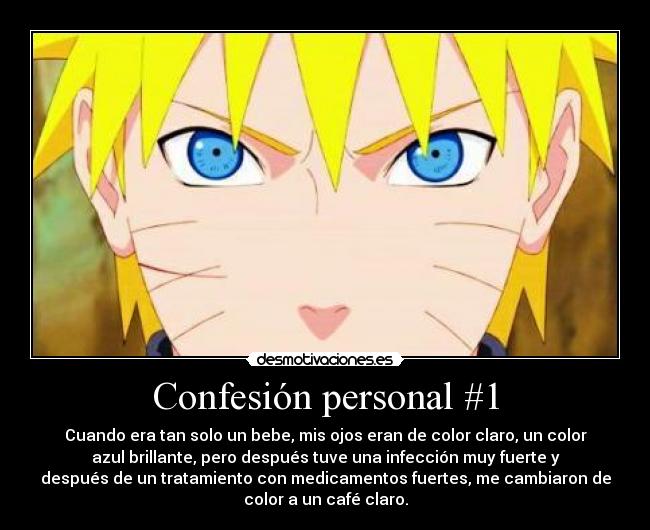Confesión personal #1 - Cuando era tan solo un bebe, mis ojos eran de color claro, un color
azul brillante, pero después tuve una infección muy fuerte y
después de un tratamiento con medicamentos fuertes, me cambiaron de
color a un café claro.