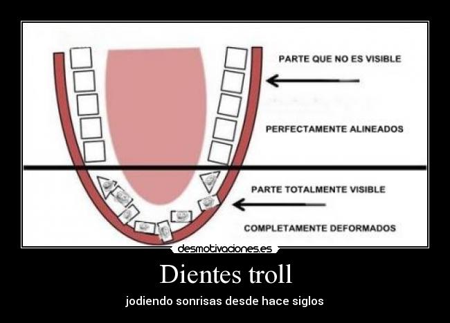 Dientes troll - jodiendo sonrisas desde hace siglos