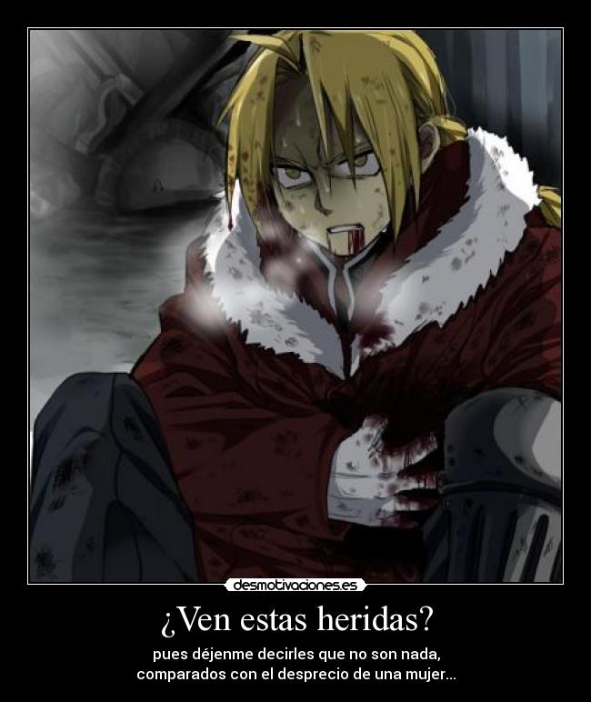 ¿Ven estas heridas? - 