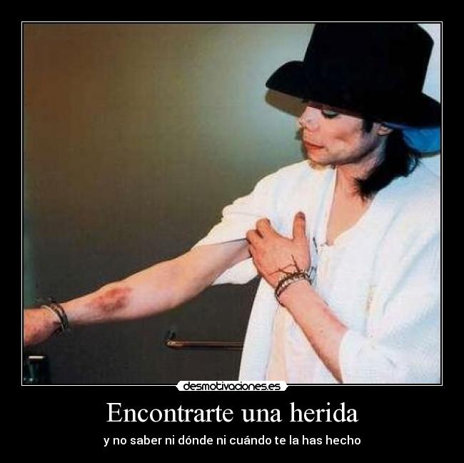 Encontrarte una herida - 
