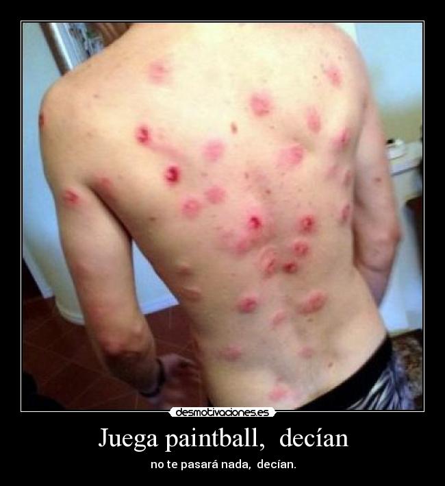 Juega paintball,  decían - no te pasará nada,  decían.