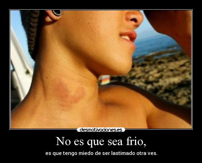 No es que sea frio, - es que tengo miedo de ser lastimado otra ves.