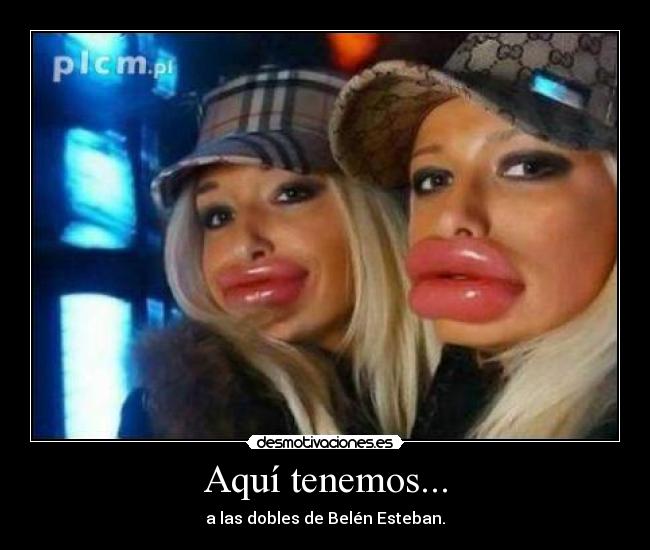 Aquí tenemos... - a las dobles de Belén Esteban.